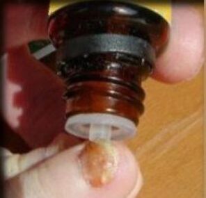 Tantak aplikatzea onddoek eragindako oinetako iltze batean